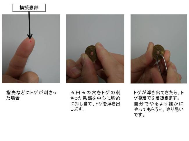 トゲが刺さったときには5円玉が便利です 警視庁